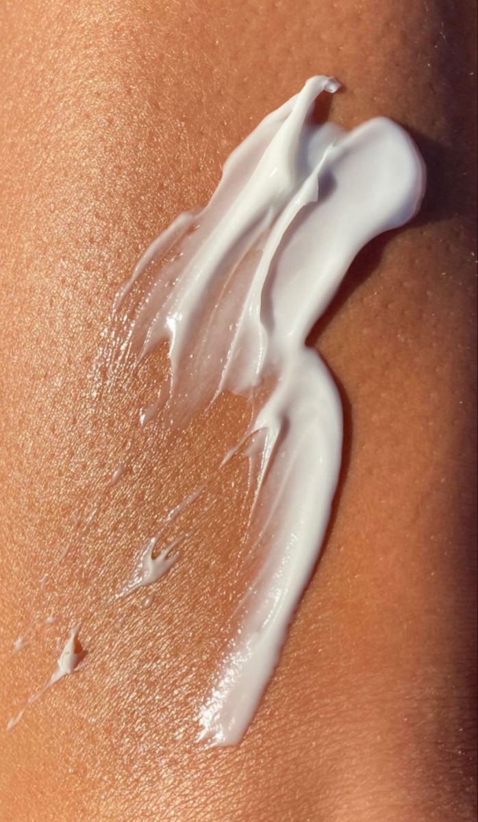 Stretch Marks